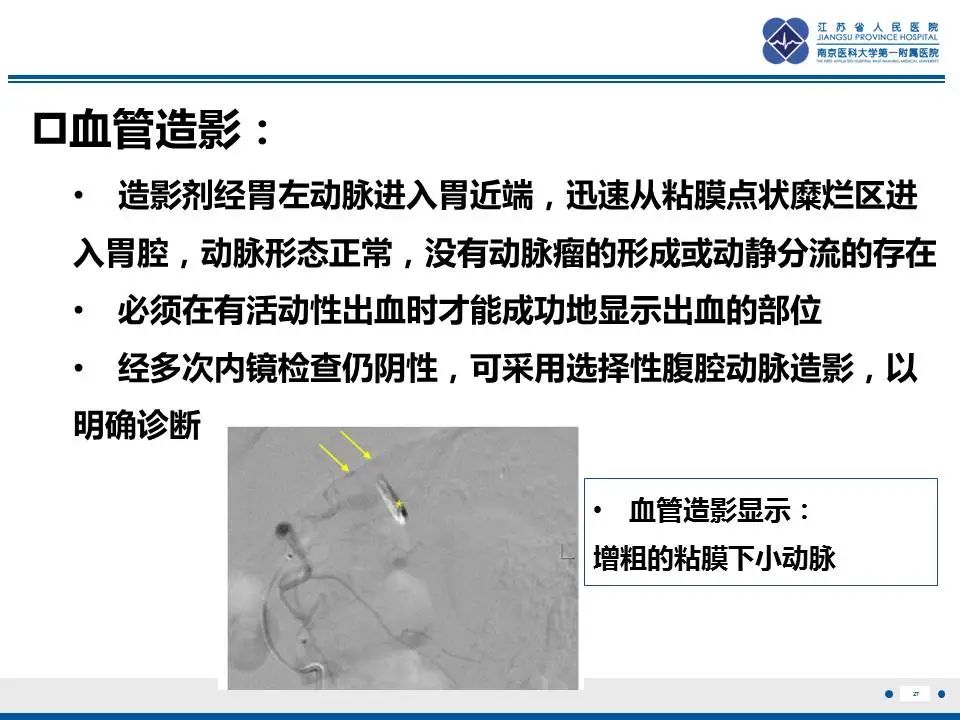 【PPT】胃恒径动脉综合征-28