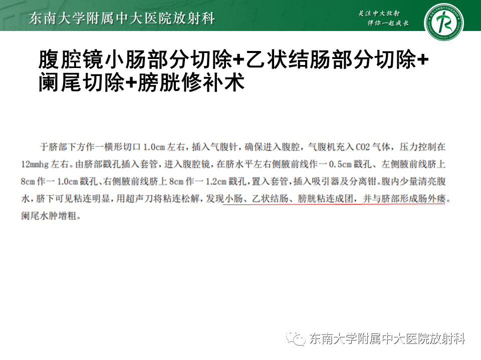 【PPT】克罗恩（Crohn’s）病-9