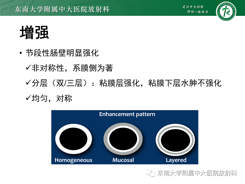 【PPT】克罗恩（Crohn’s）病-23