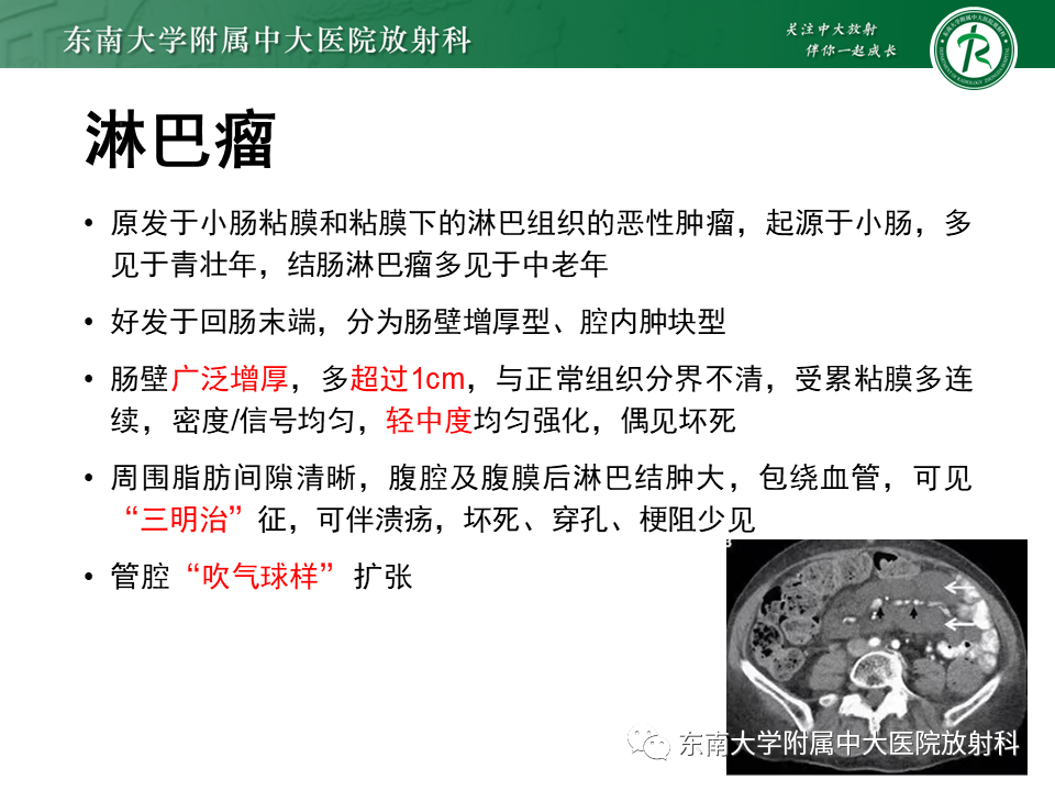 【PPT】克罗恩（Crohn’s）病-46