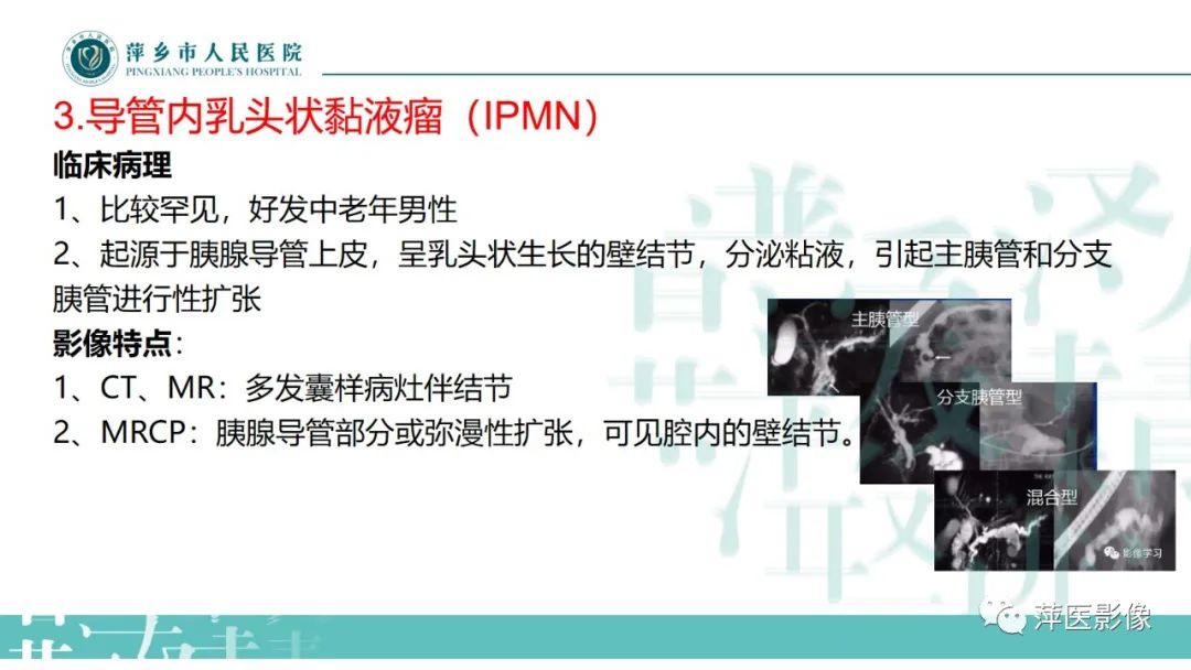 【PPT】胰腺实性假乳头状瘤-23