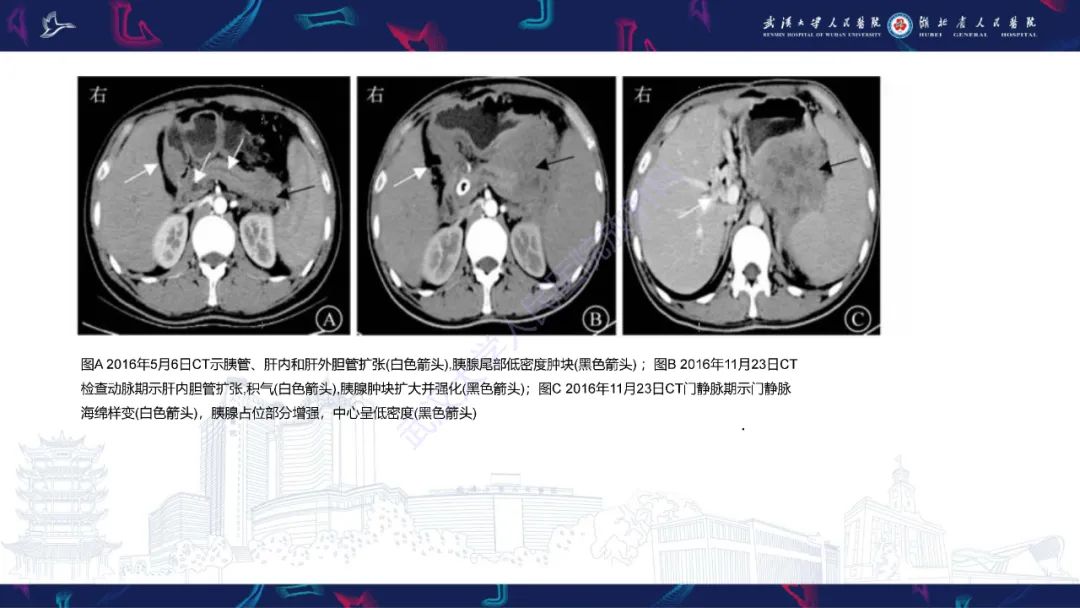 【PPT】阴道髓系肉瘤影像诊断-19