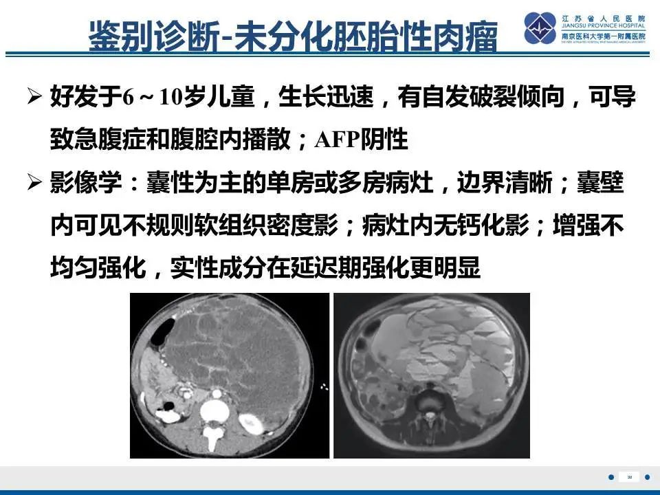 【PPT】肝淋巴瘤-31