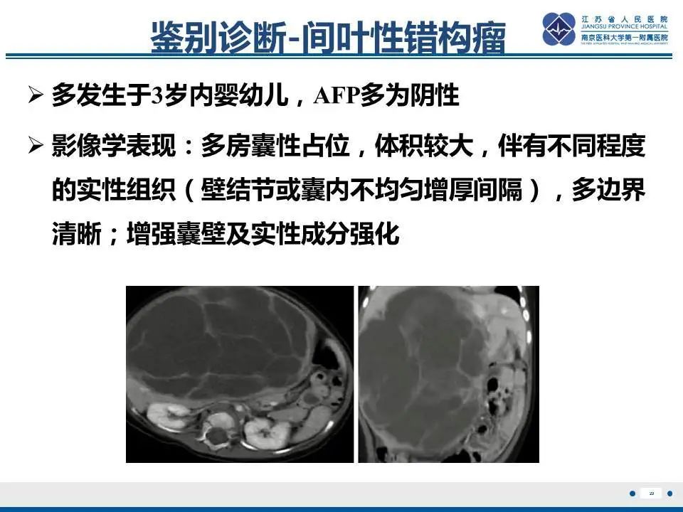 【PPT】肝淋巴瘤-30
