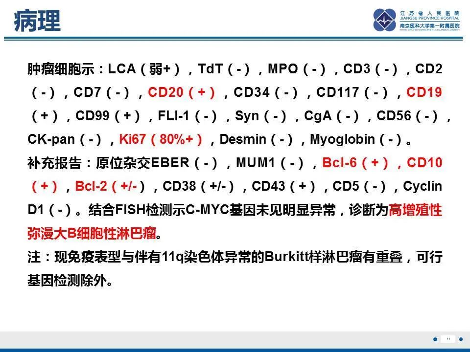 【PPT】肝淋巴瘤-12