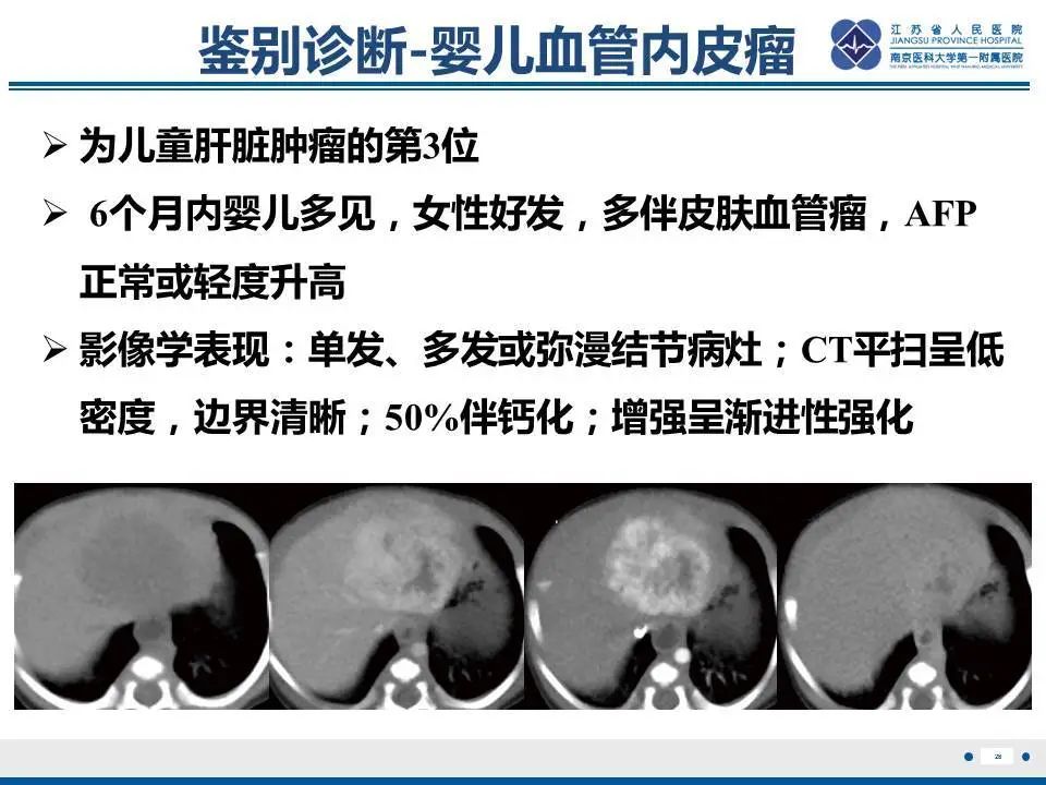 【PPT】肝淋巴瘤-29