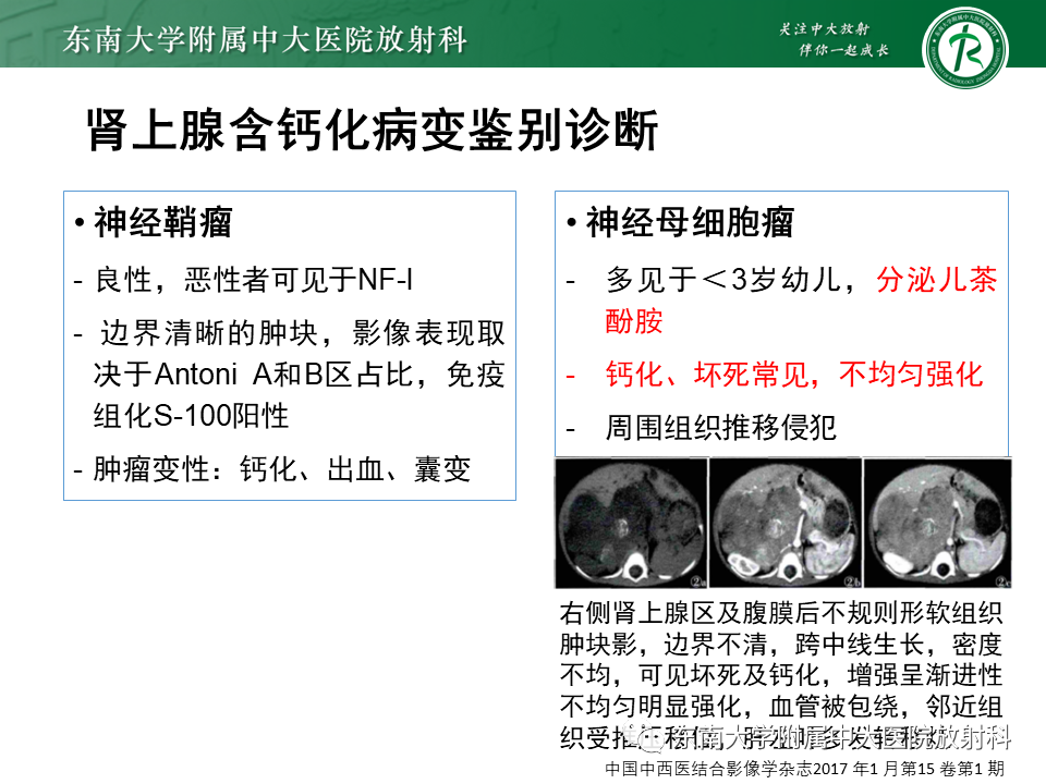 【PPT】肾上腺占位病例随访-13
