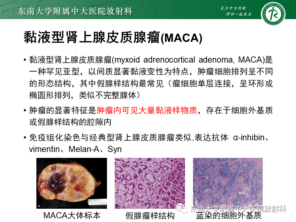【PPT】肾上腺占位病例随访-29