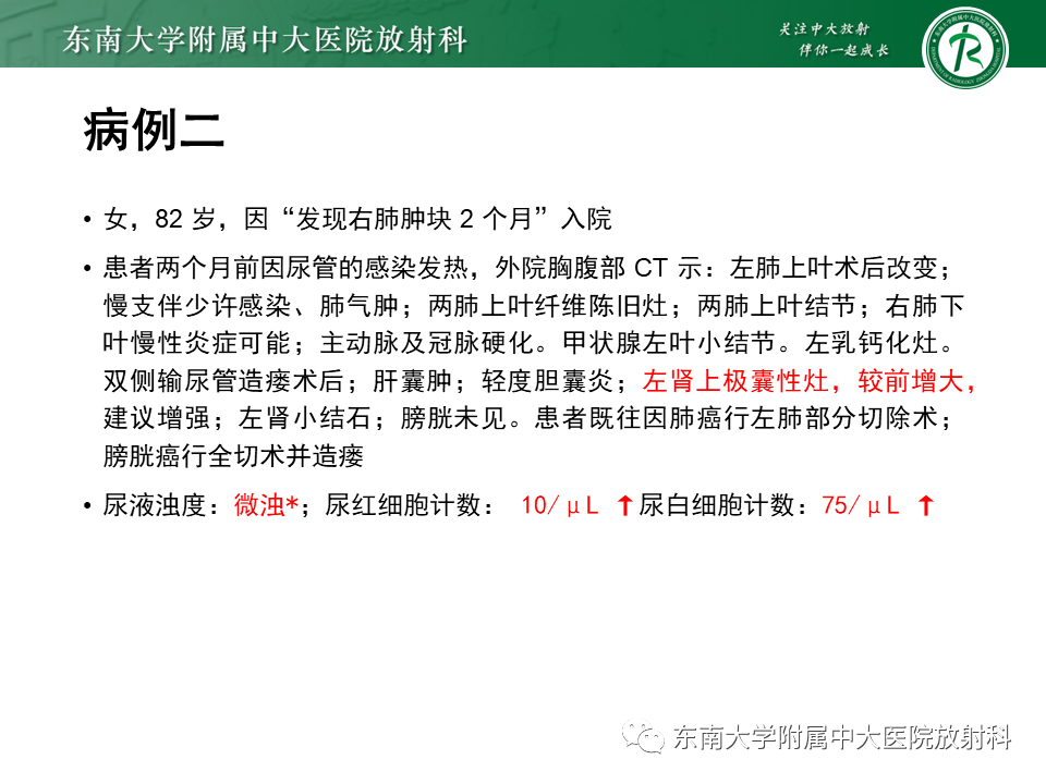 【PPT】肾上腺占位病例随访-8