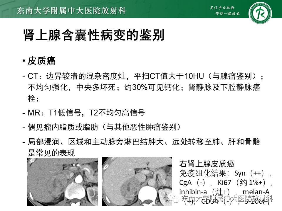 【PPT】肾上腺占位病例随访-27