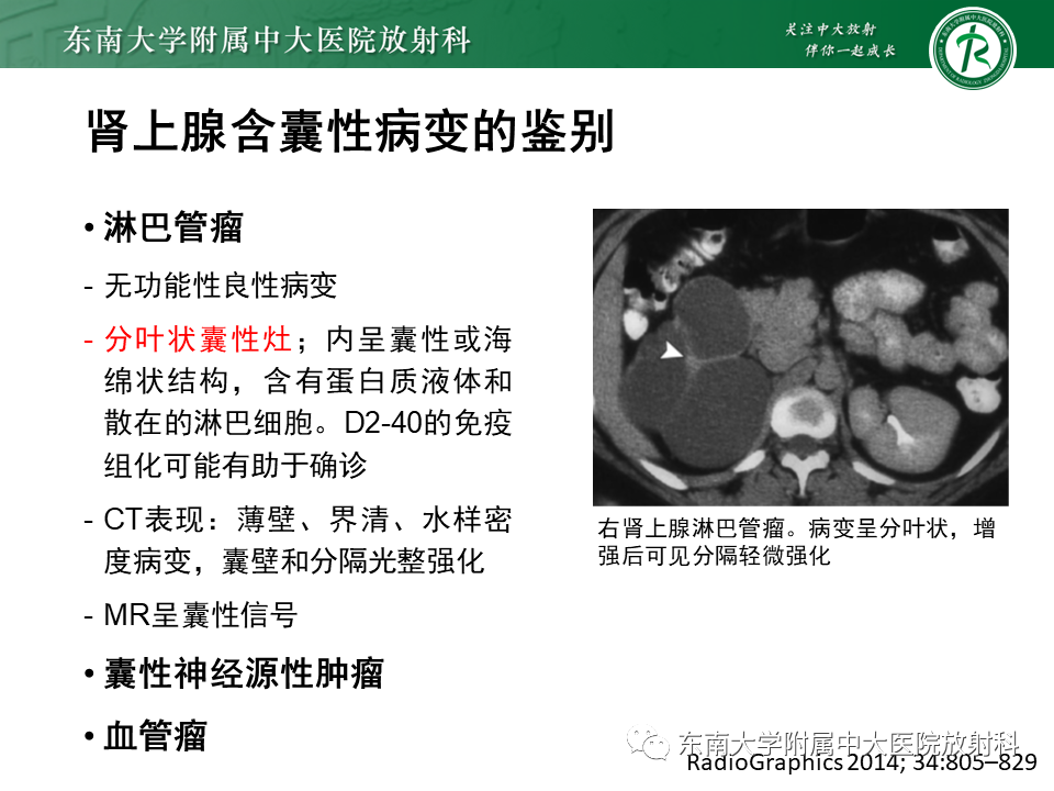 【PPT】肾上腺占位病例随访-24