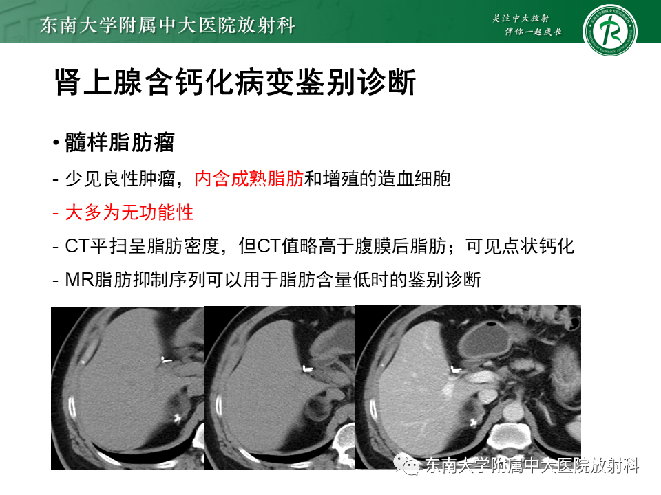 【PPT】肾上腺占位病例随访-14