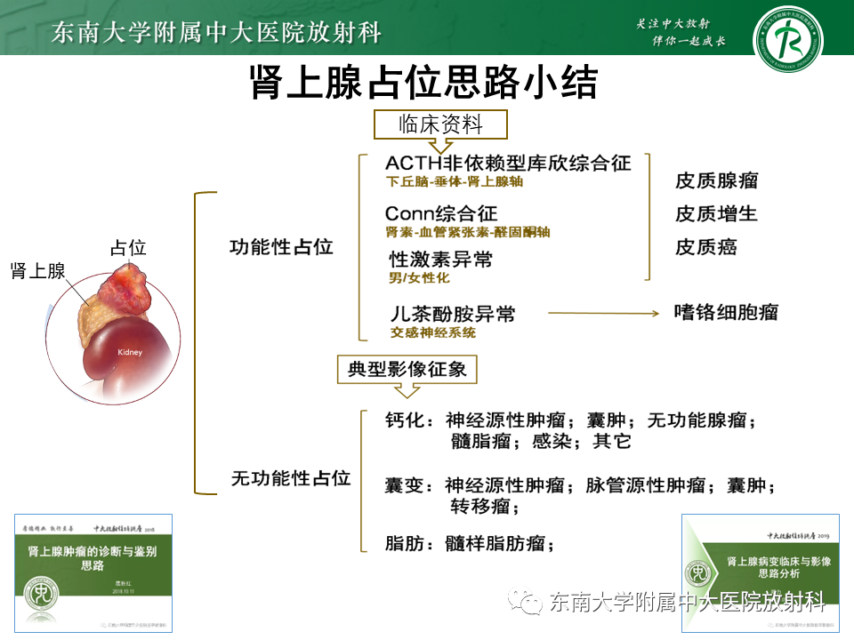 【PPT】肾上腺占位病例随访-31