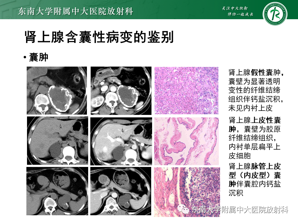 【PPT】肾上腺占位病例随访-23