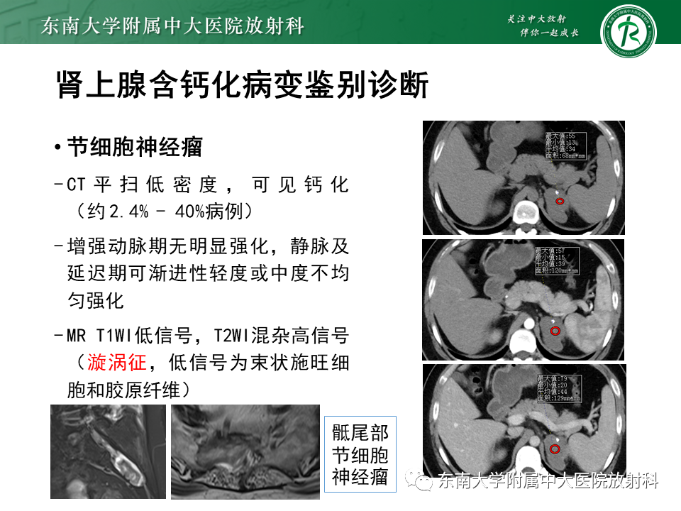 【PPT】肾上腺占位病例随访-9