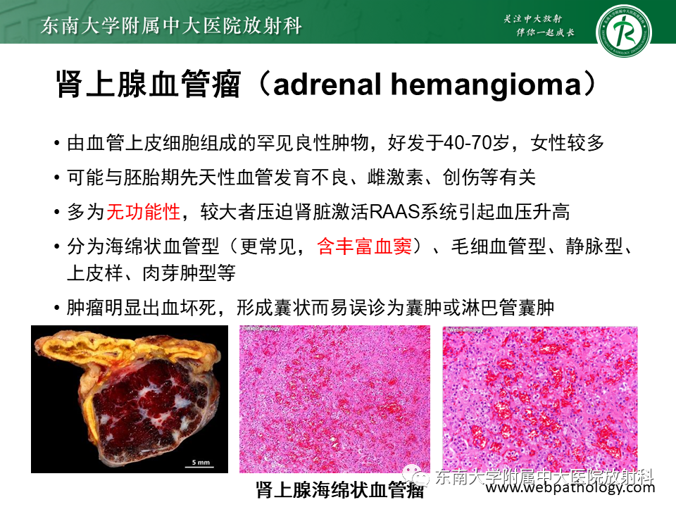 【PPT】肾上腺占位病例随访-6