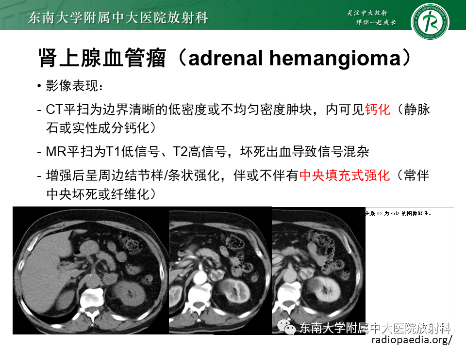 【PPT】肾上腺占位病例随访-7