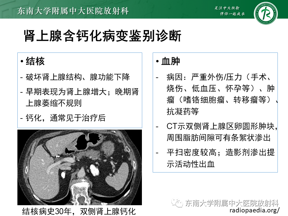 【PPT】肾上腺占位病例随访-15
