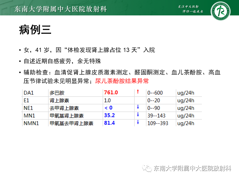 【PPT】肾上腺占位病例随访-1