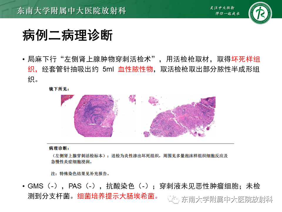 【PPT】肾上腺占位病例随访-10