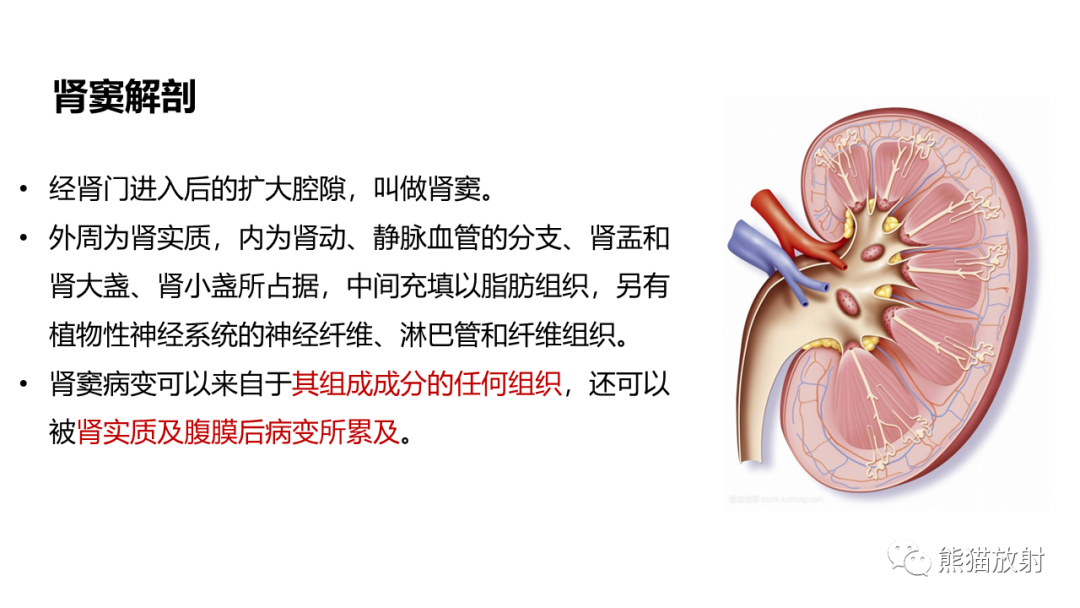 【PPT】肾窦病变影像诊断思路-19
