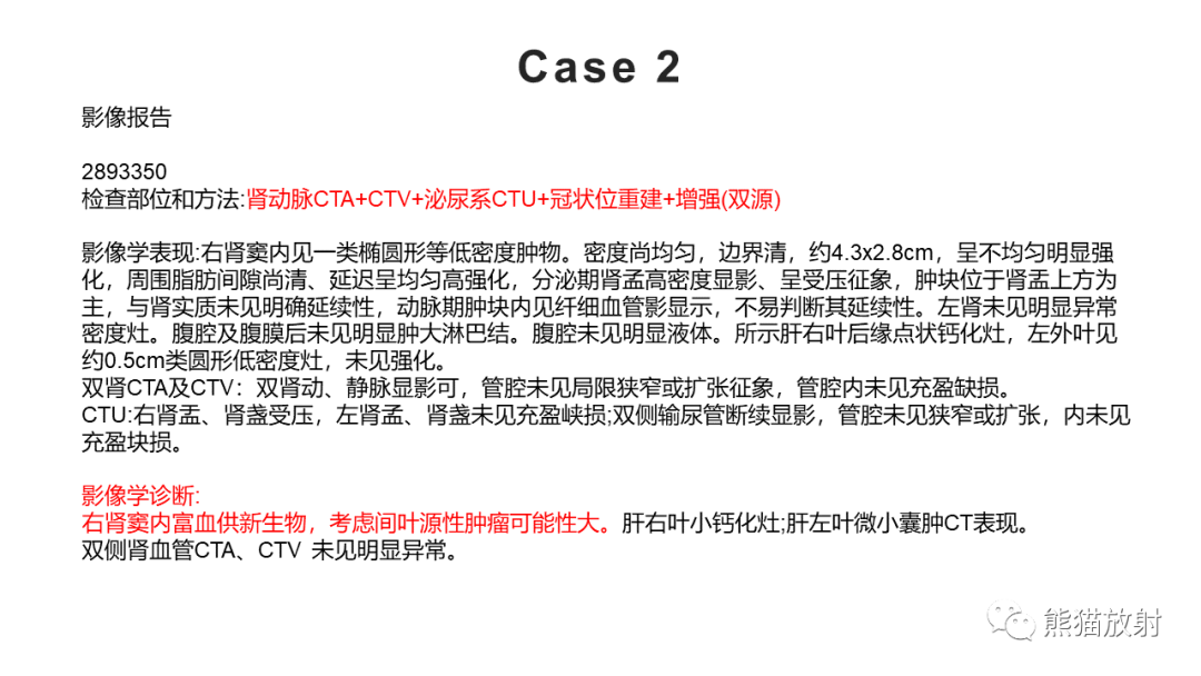 【PPT】肾窦病变影像诊断思路-16