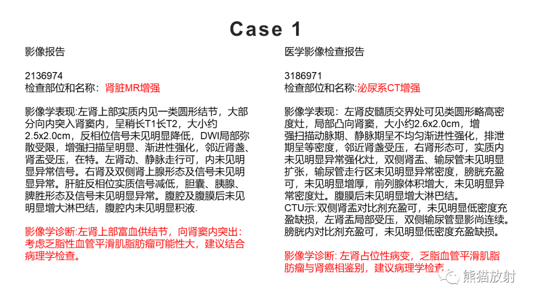 【PPT】肾窦病变影像诊断思路-14