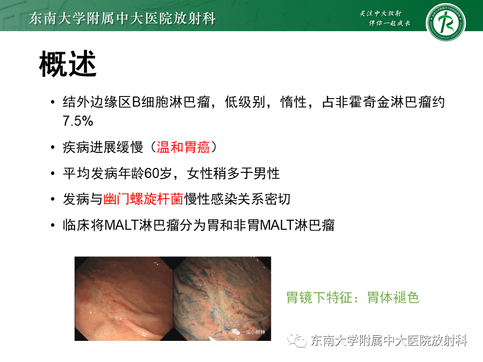 【PPT】胃黏膜相关淋巴组织(MALT)淋巴瘤-5