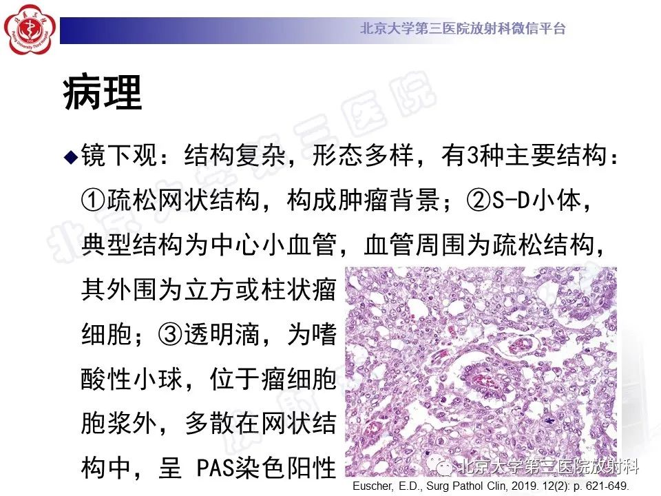 【PPT】卵巢卵黄囊瘤/内胚窦瘤-12