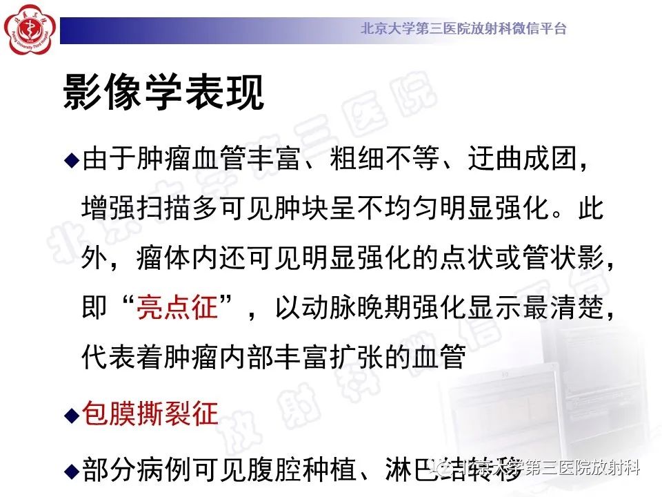 【PPT】卵巢卵黄囊瘤/内胚窦瘤-15