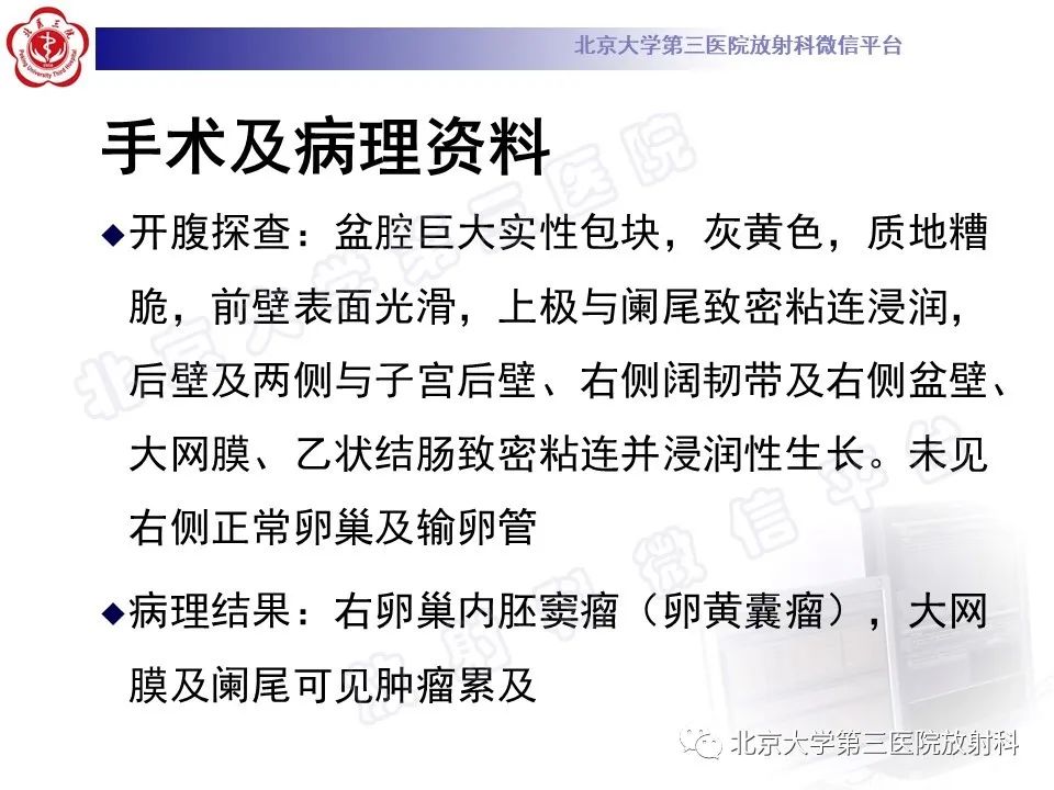 【PPT】卵巢卵黄囊瘤/内胚窦瘤-8