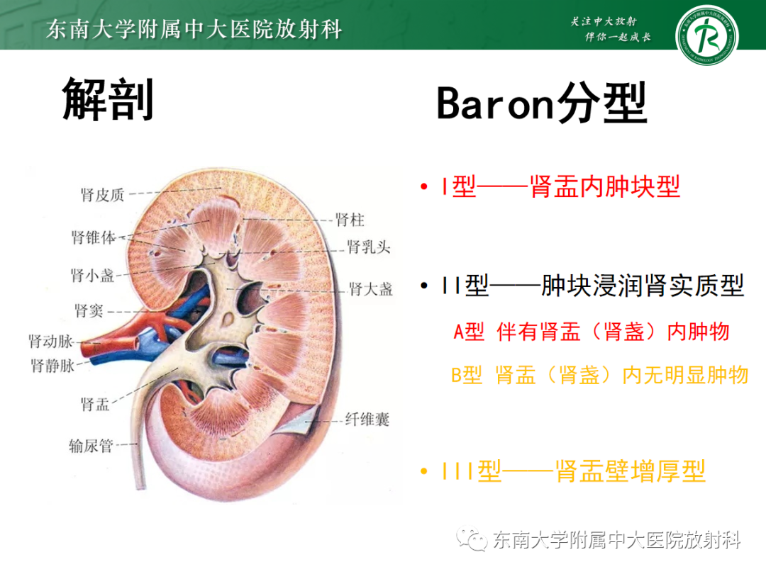 【PPT】肾盂癌-9