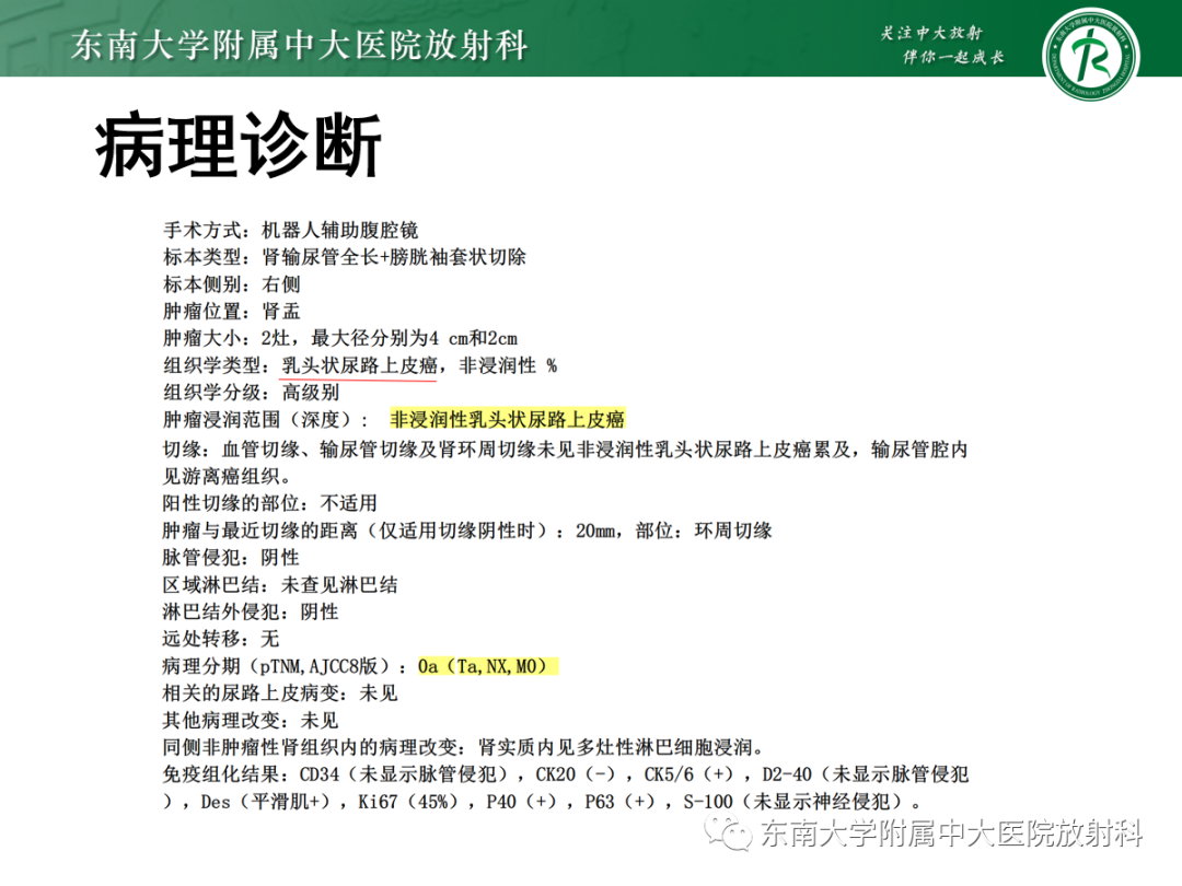 【PPT】肾盂癌-23