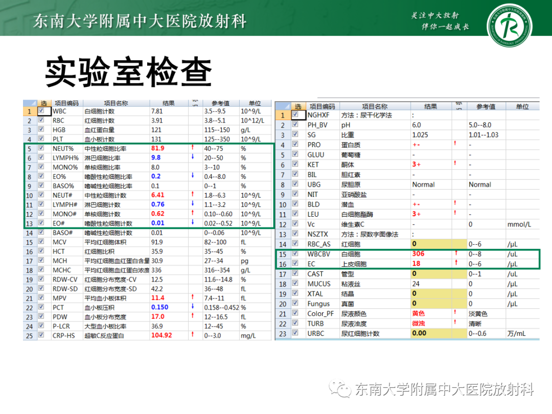 【PPT】肾盂癌-28