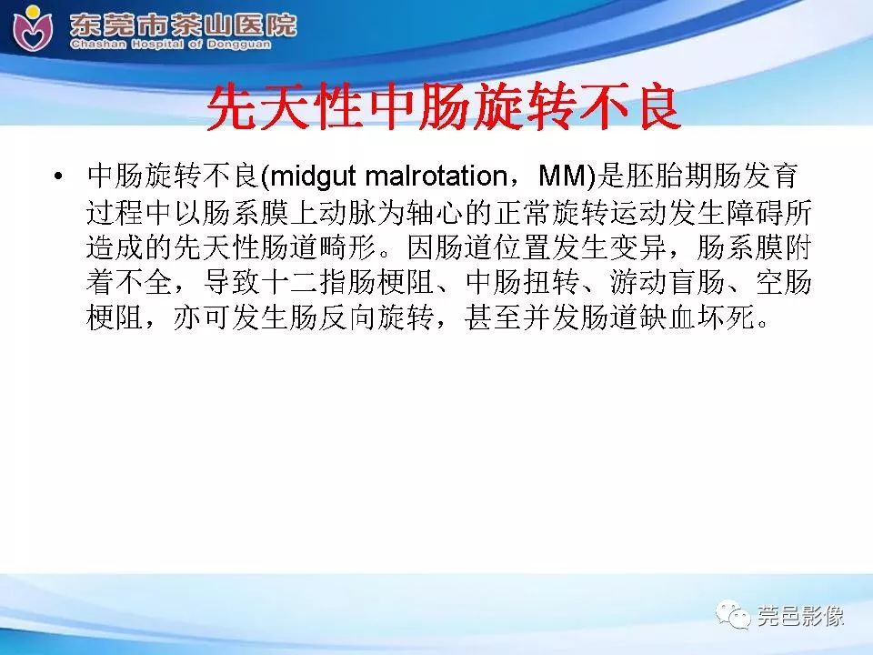 【PPT】腹茧症的影像诊断-53