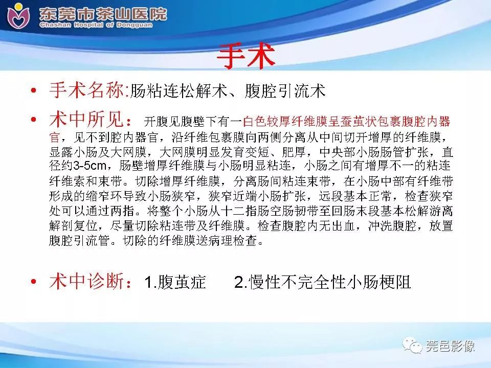 【PPT】腹茧症的影像诊断-19