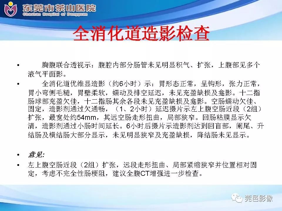 【PPT】腹茧症的影像诊断-9