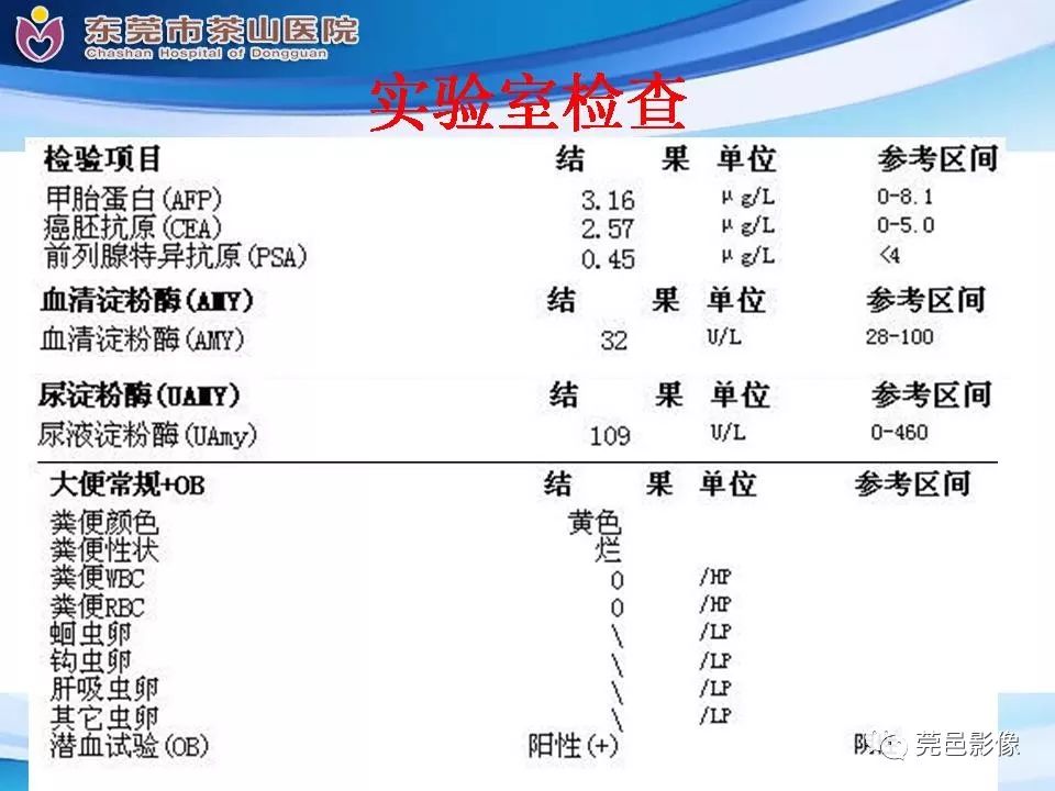 【PPT】腹茧症的影像诊断-5
