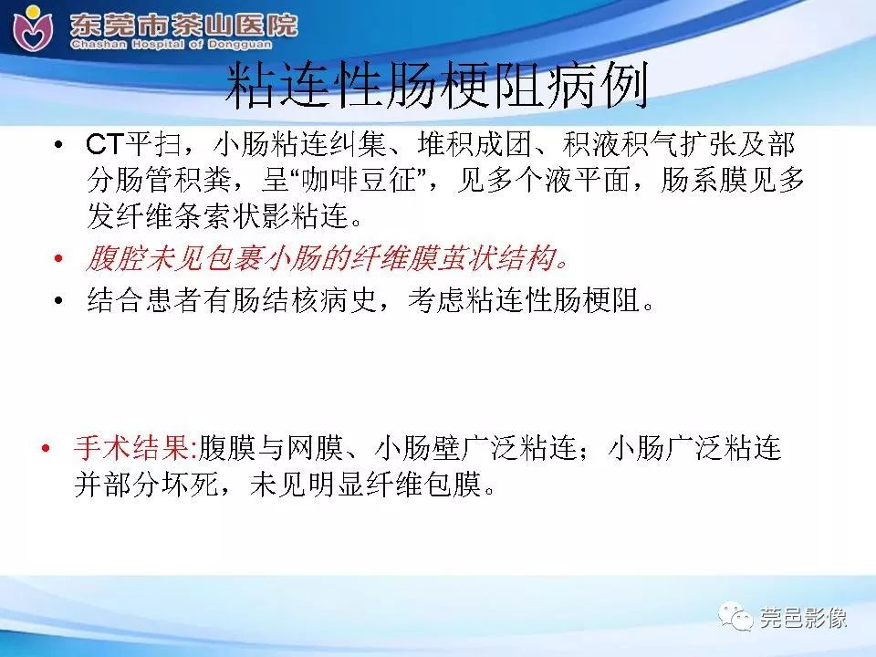 【PPT】腹茧症的影像诊断-52
