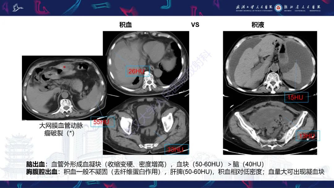 【PPT】盆腹腔巨大占位性病变影像诊断-11
