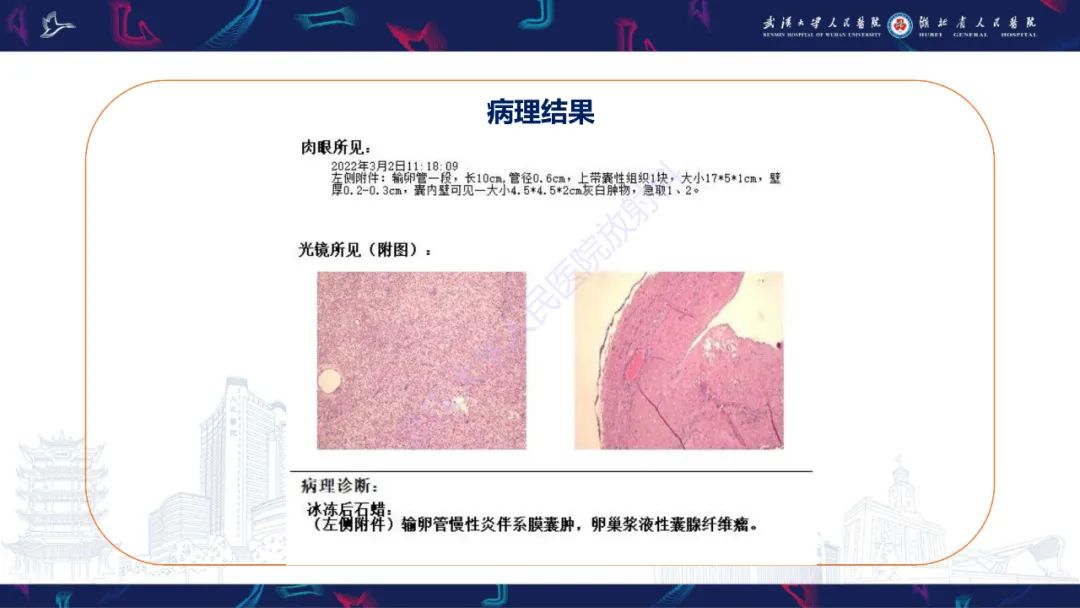 【PPT】盆腹腔巨大占位性病变影像诊断-5
