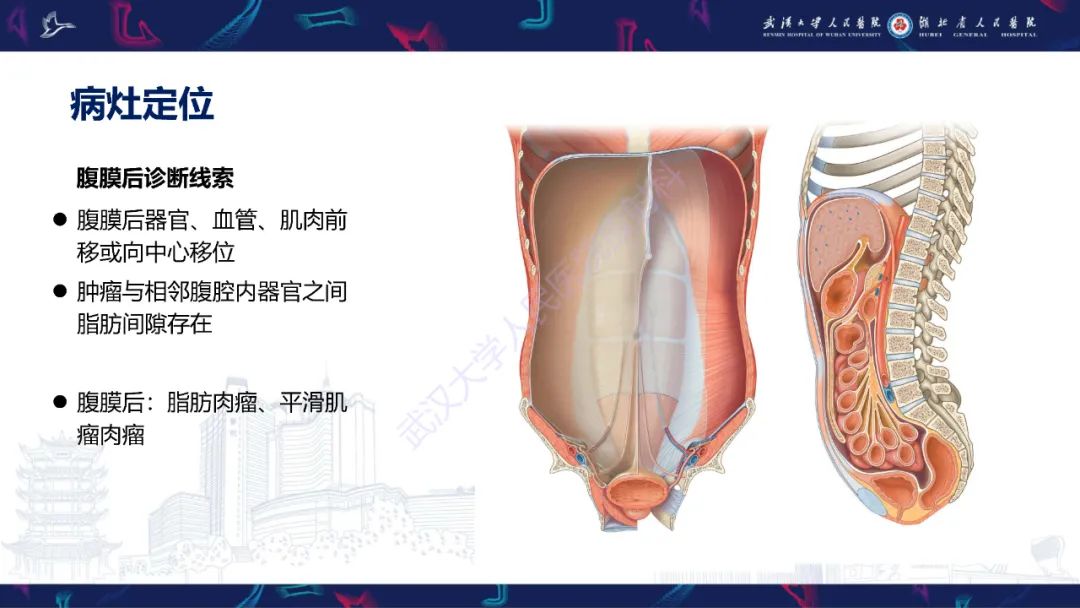【PPT】盆腹腔巨大占位性病变影像诊断-42