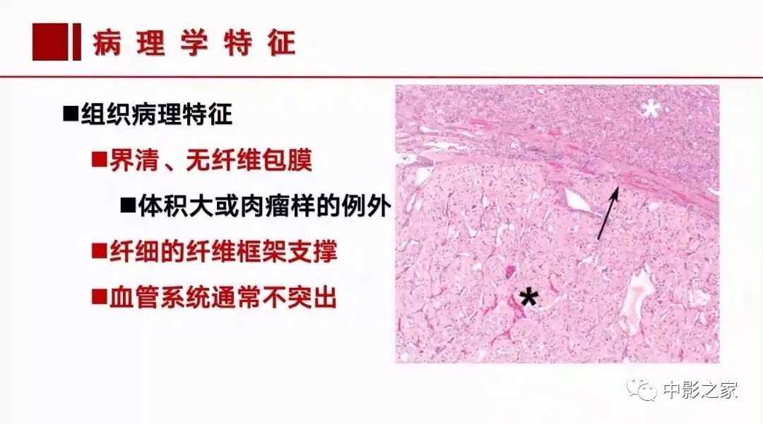 【PPT】肾嫌色细胞癌影像诊断、鉴别、分级与预后评估-13