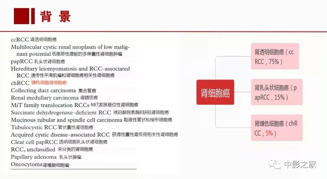 【PPT】肾嫌色细胞癌影像诊断、鉴别、分级与预后评估-5