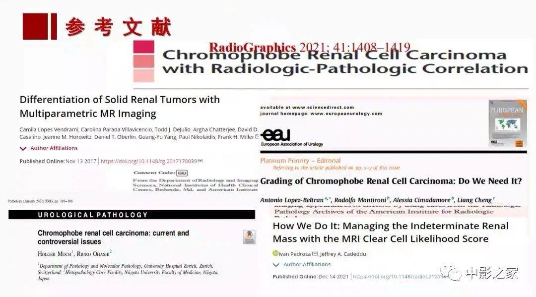 【PPT】肾嫌色细胞癌影像诊断、鉴别、分级与预后评估-2