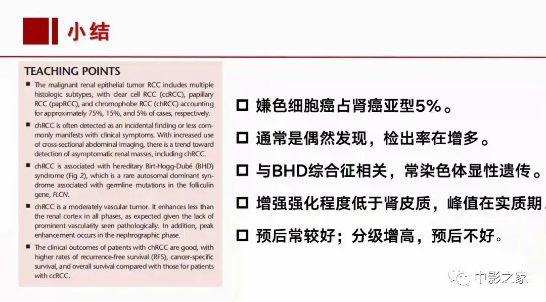 【PPT】肾嫌色细胞癌影像诊断、鉴别、分级与预后评估-1