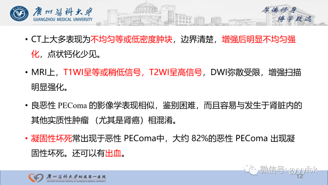 【PPT】肾少见肿瘤影像诊断的文献汇报-12