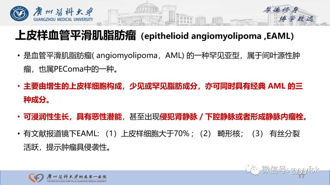 【PPT】肾少见肿瘤影像诊断的文献汇报-17