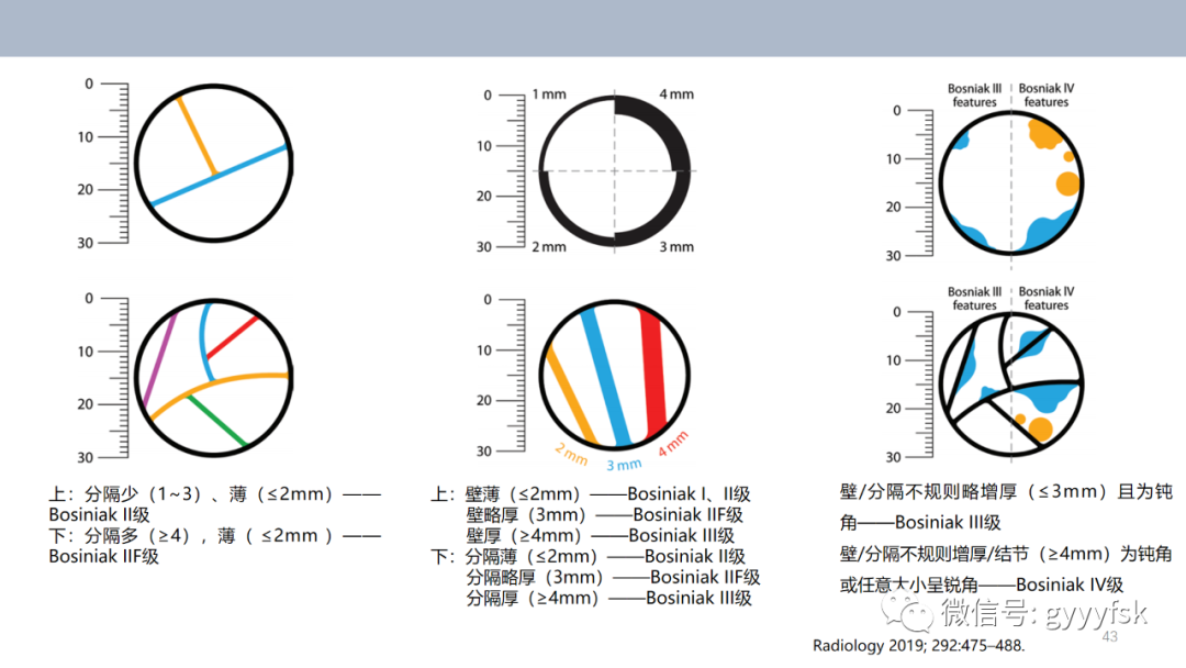 【PPT】肾少见肿瘤影像诊断的文献汇报-43