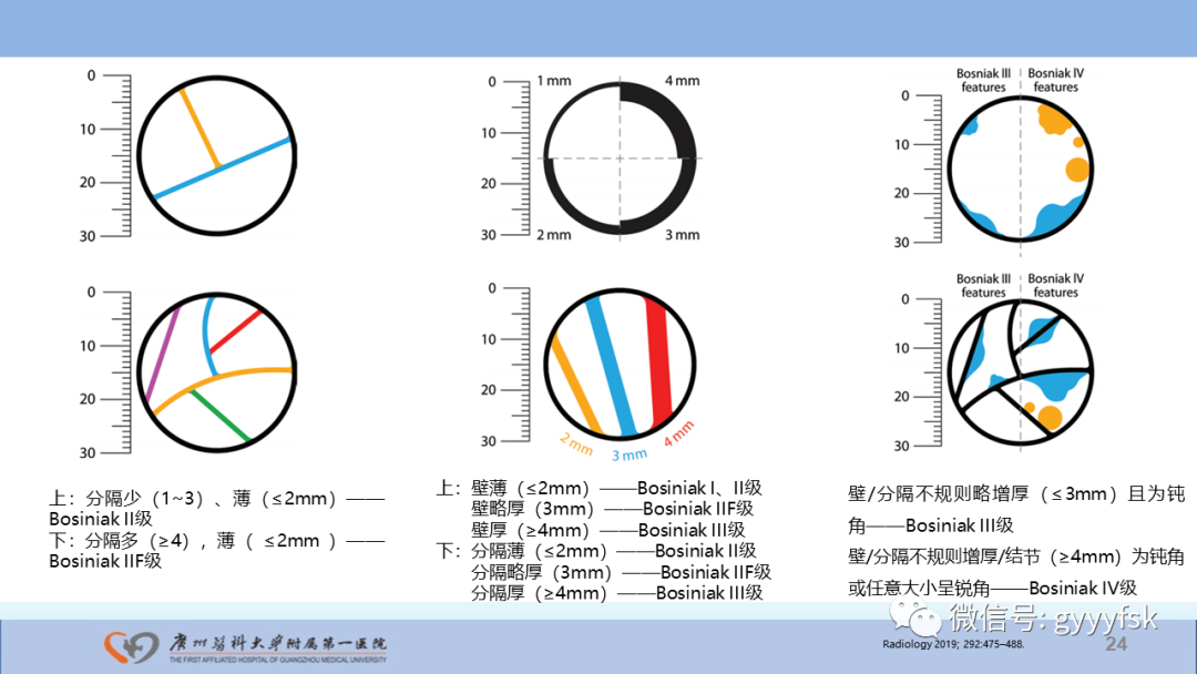 【PPT】肾癌相关影像诊断的文献汇报-24